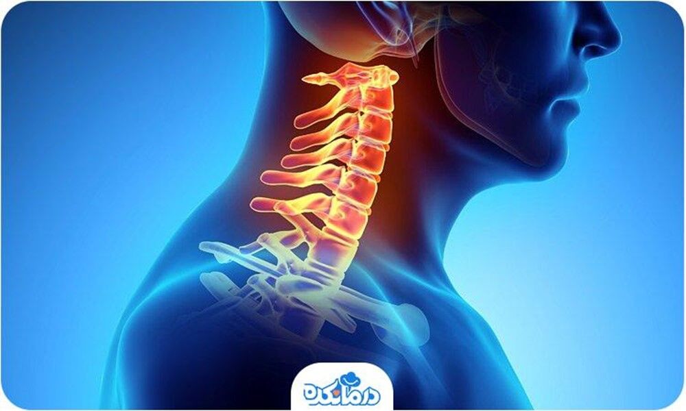 راه‌کارهای کنترل و درمان دیسک گردن